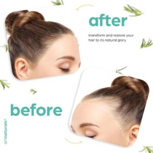 ArtNaturals Organic Rosemary & Castor Hair Growth Oil + Scalp Massager Set – 4 oz – Natural Hair Oil with Coconut & Olive Oils for Dry, Damaged Hair & Split Ends 11 ArtNaturals hair growth oil